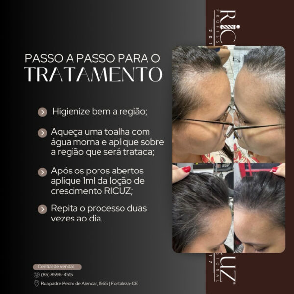 Loção De Crescimento 120g Ricuz Profissional - Image 2
