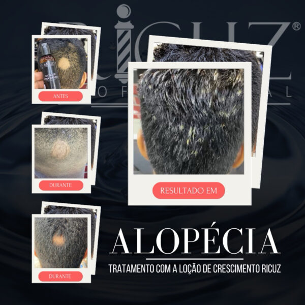 Loção De Crescimento 120g Ricuz Profissional - Image 3